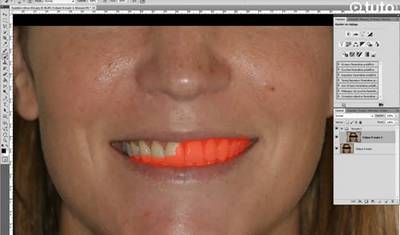 dents-blanches-Photoshop